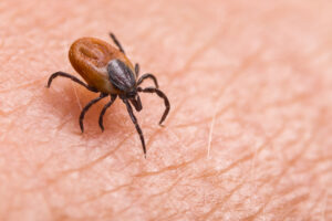 Close-up view of a tick crawling on human skin, highlighting the detailed texture of both the tick and the skin.